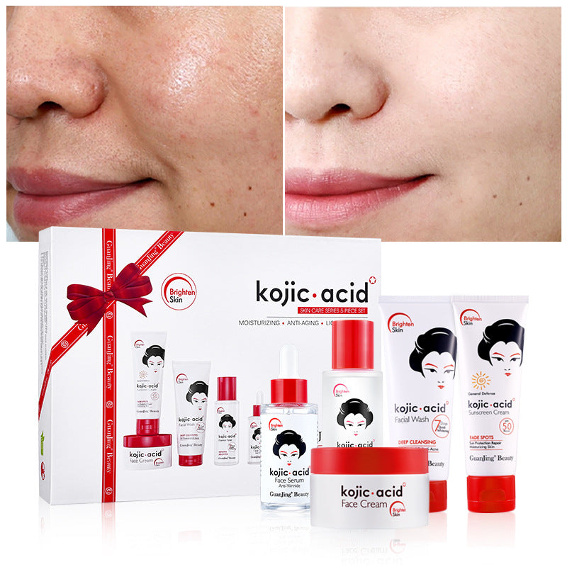 Kojic Acid Toner & Lotion Set | Brightening Skincare Duo