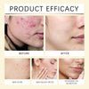 Turmeric Kojic Acid Cleansing Gasket | Daily Facial Cleanser