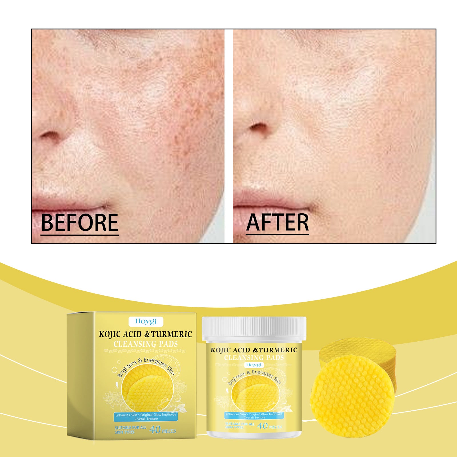 Turmeric Kojic Acid Cleansing Gasket | Daily Facial Cleanser